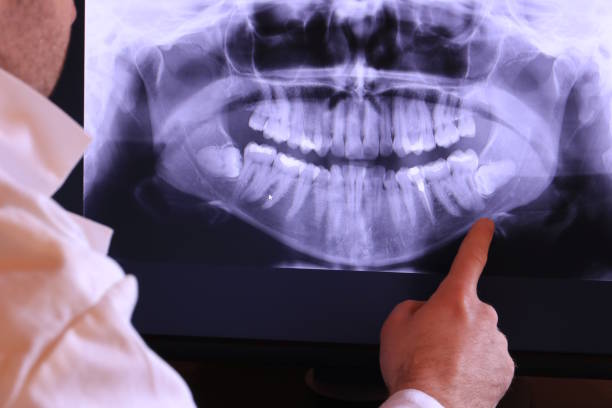 Best Emergency Cosmetic Dentistry in Canton, MO