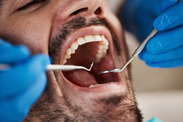 Best Orthodontic Emergency Dentist in Canton, MO